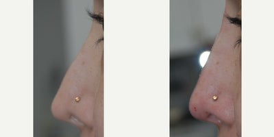 before and after image