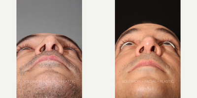 before and after image