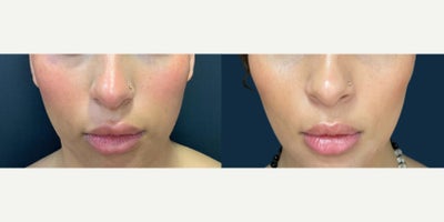 before and after image