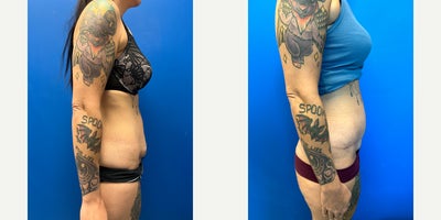 before and after image