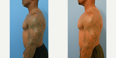 before and after image