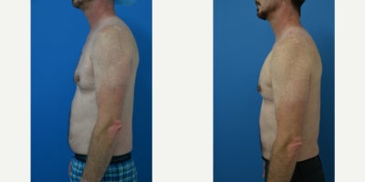 before and after image