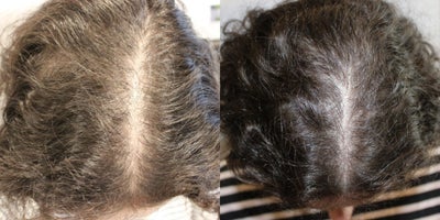 before and after image