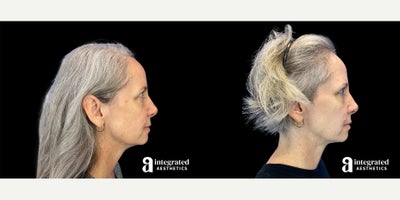 before and after image