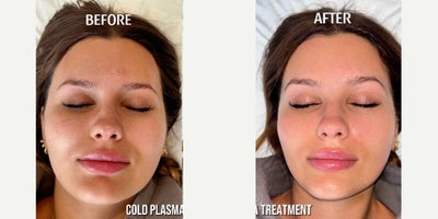 before and after image