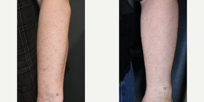before and after image
