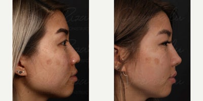 before and after image