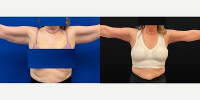 before and after image