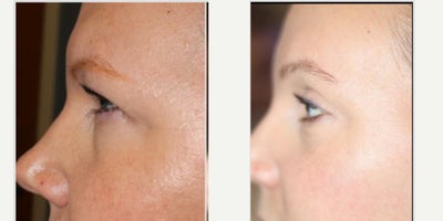 before and after image