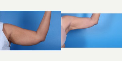 before and after image