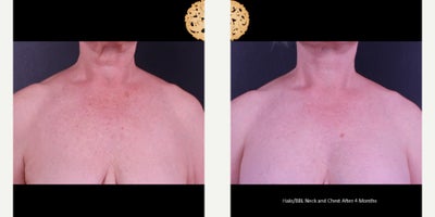 before and after image