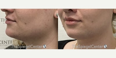 before and after image