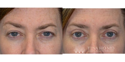 before and after image