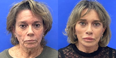 before and after image
