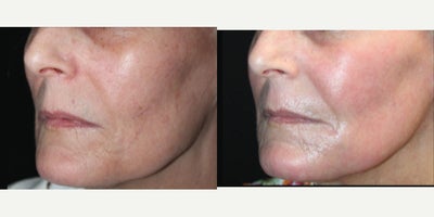 before and after image