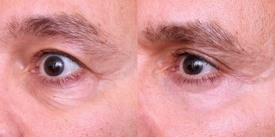 DeepFX before and after photo