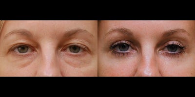 before and after image