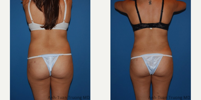 before and after image