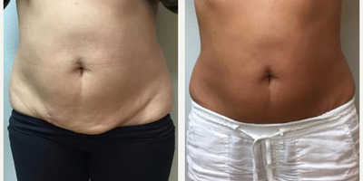 before and after image