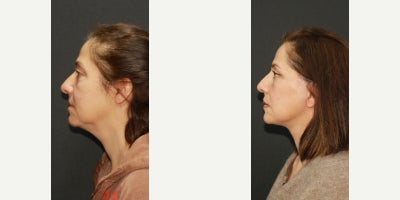 before and after image