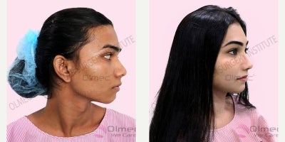 before and after image