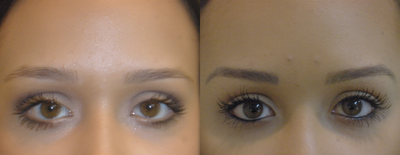 before and after image