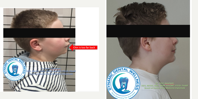 DNA Appliance before and after photo