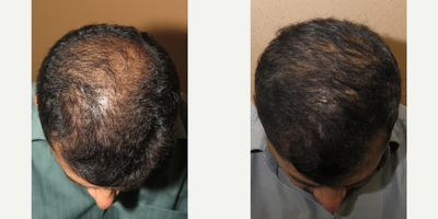 before and after image