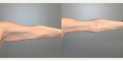before and after image