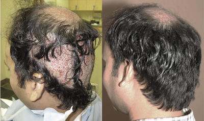 before and after image