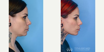 before and after image