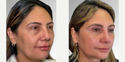 before and after image