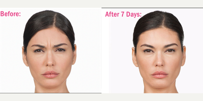 before and after image
