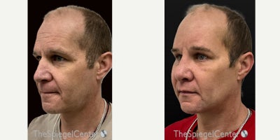 before and after image