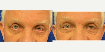 before and after image