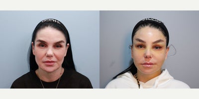 before and after image