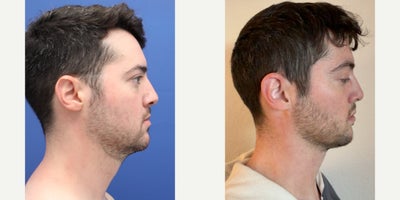 before and after image
