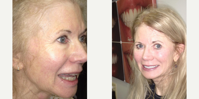 before and after image
