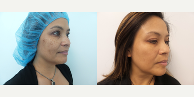 before and after image