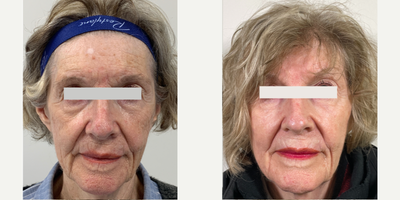before and after image