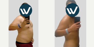 before and after image