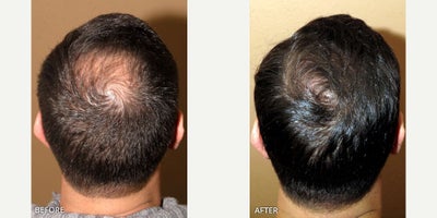 before and after image