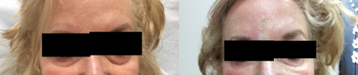 before and after image