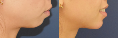 before and after image