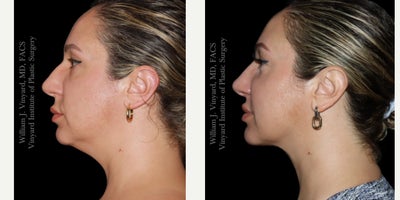 before and after image