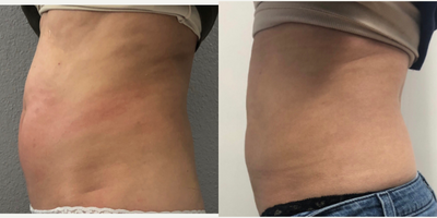 before and after image