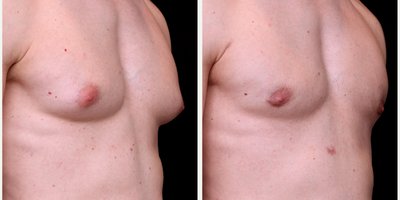 before and after image