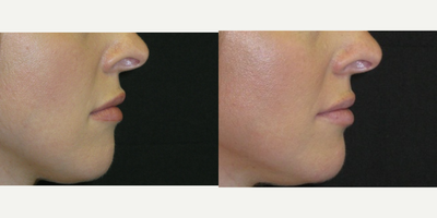before and after image