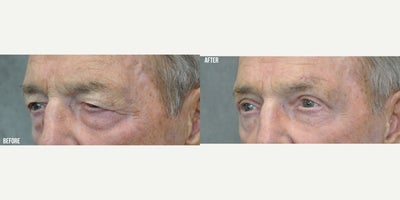 before and after image