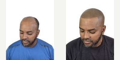 before and after image